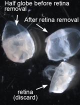 Preparation of a Single Cell Suspension from the Murine Iridocorneal Angle
