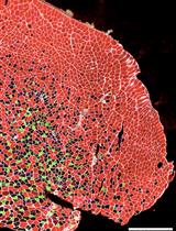 Electroporation of Small Interfering RNAs into Tibialis Anterior Muscles of Mice