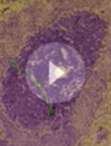 Protocol to Isolate Germinal Centers by Laser Microdissection