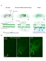 Plasma Membrane Wounding and Repair Assays for Eukaryotic Cells