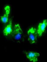 Flow Cytometric Characterization of Macrophages Infected in vitro with Salmonella enterica Serovar Typhimurium Expressing Red Fluorescent Protein