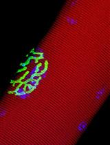 Simple Methods for Permanent or Transient Denervation in Mouse Sciatic Nerve Injury Models