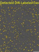 Fluorescent Labeling of Small Extracellular Vesicles (EVs) Isolated from Conditioned Media
