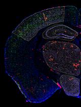 Automated Quantification of Multiple Cell Types in Fluorescently Labeled Whole Mouse Brain Sections Using QuPath