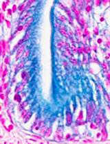 Whole-mount Senescence-Associated Beta-Galactosidase (SA-β-GAL) Activity Detection Protocol for Adult Zebrafish