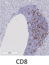 Immunohistochemistry of Immune Cells and Cells Bound to <em>in vivo</em> Administered Antibodies in Liver, Lung, Pancreas, and Colon of B6/lpr Mice