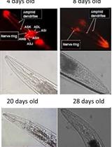 Analysis of <em>Caenorhabditis elegans</em> Aging-related Neurodegeneration in Chemosensory Neurons