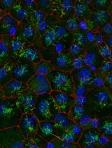 Purification and Immunostaining of Mouse Ependymal Ciliary Shafts