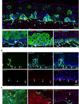 Isolation and <em>ex vivo</em> Expansion of Limbal Mesenchymal Stromal Cells