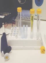 Evaluation of Urine Proteins by Capillary Electrophoresis