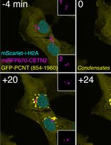 TRACES: a Freely Accessible, Semi-automated Pipeline for Detection, Tracking, and Quantification of Fluorescently Labeled Cellular Structures