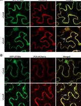 Colocalization Assay with Fluorescent-tagged ATG8 Using a <em>Nicotiana benthamiana</em>-based Transient System