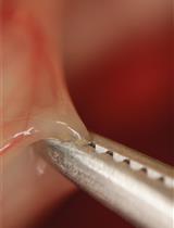 Combination of Sterile Injury and Microbial Contamination to Model Post-surgical Peritoneal Adhesions in Mice