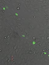 Detection of Alternative End-Joining in HNSC Cell Lines Using DNA Double-Strand Break Reporter Assays