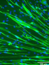 Generation of iMyoblasts from Human Induced Pluripotent Stem Cells