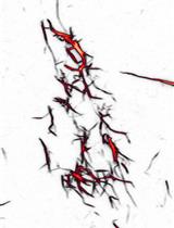 In vitro Fluorescence Imaging–based Actin Bundling Assay