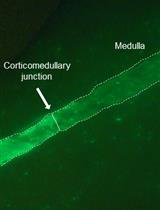 一种用于肾活检标本现场评估的新型成像技术