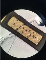 Serial Room Temperature Crystal Loading, Data Collection, and Data Processing of Human Glutaminase C in Complex with Allosteric Inhibitors