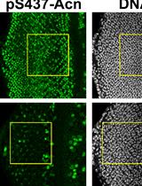 In situ Dephosphorylation Assay with Recombinant Nil Phosphatase