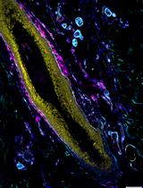 Human Skin Explant Preparation and Culture