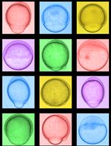Gastrulation Screening to Identify Anti-metastasis Drugs in Zebrafish Embryos