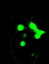 LIST: A Newly Developed Laser-assisted Cell Bioprinting Technology