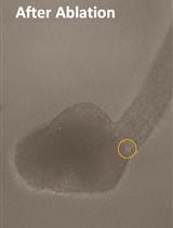 MiniSOG2-mediated Specific Photoablation of Motor Neurons in Ascidian Embryos