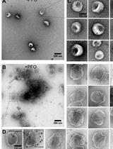 Negative Staining Transmission Electron Microscopy of HIV Viral Particles Permeabilized with PFO and Capsid Stabilized with IP6
