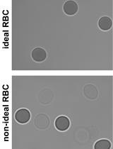 Single-molecule Force Spectroscopy on Biomembrane Force Probe to Characterize Force-dependent Bond Lifetimes of Receptor–ligand Interactions on Living Cells 
