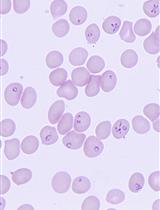 促进巴贝虫生物学、发病机制和治疗的巴贝虫培养和小鼠（ICIM）模型