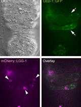 监测秀丽隐杆线虫凋亡细胞清除过程中自噬体与吞噬体的募集与融合