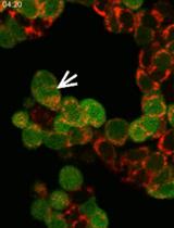 Fluorescence Time-lapse Imaging of Entosis Using Tetramethylrhodamine Methyl Ester Staining