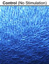 Stimulation of Human Periodontal Ligament Fibroblasts Using Purified Dentilisin Extracted from <em>Treponema denticola</em>