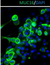 Isolation and Expansion of Primary Conjunctival Stem Cells (CjSCs) from Human and Rabbit Tissues