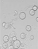 Sclerotinia sclerotiorum Protoplast Preparation and Transformation