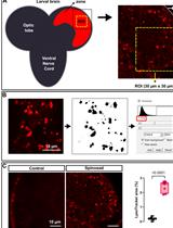 In vivo Assessment of Lysosomal Stress in the Drosophila Brain Using Confocal Fluorescence Microscopy