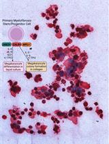 来自骨髓增生性肿瘤患者的造血祖细胞的血小板生成素不依赖性巨核细胞分化