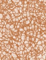 Update Notice: Semi-quantitative Determination of Protein Expression Using Immunohistochemistry Staining and Analysis