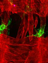 Dual-Color Live Imaging of Adult Muscle Stem Cells in the Embryonic Tissues of Drosophila melanogaster