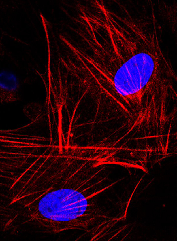 Isolation and Culture of Primary Fibroblasts from Neonatal Murine Hearts to Study Cardiac Fibrosis