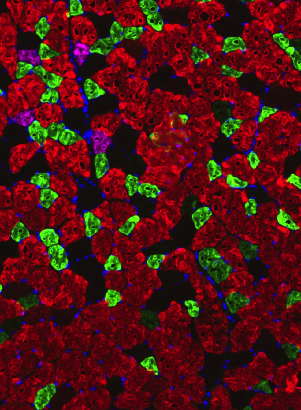 Comprehensive Analyses of Muscle Function, Lean and Muscle Mass, and Myofiber Typing in Mice