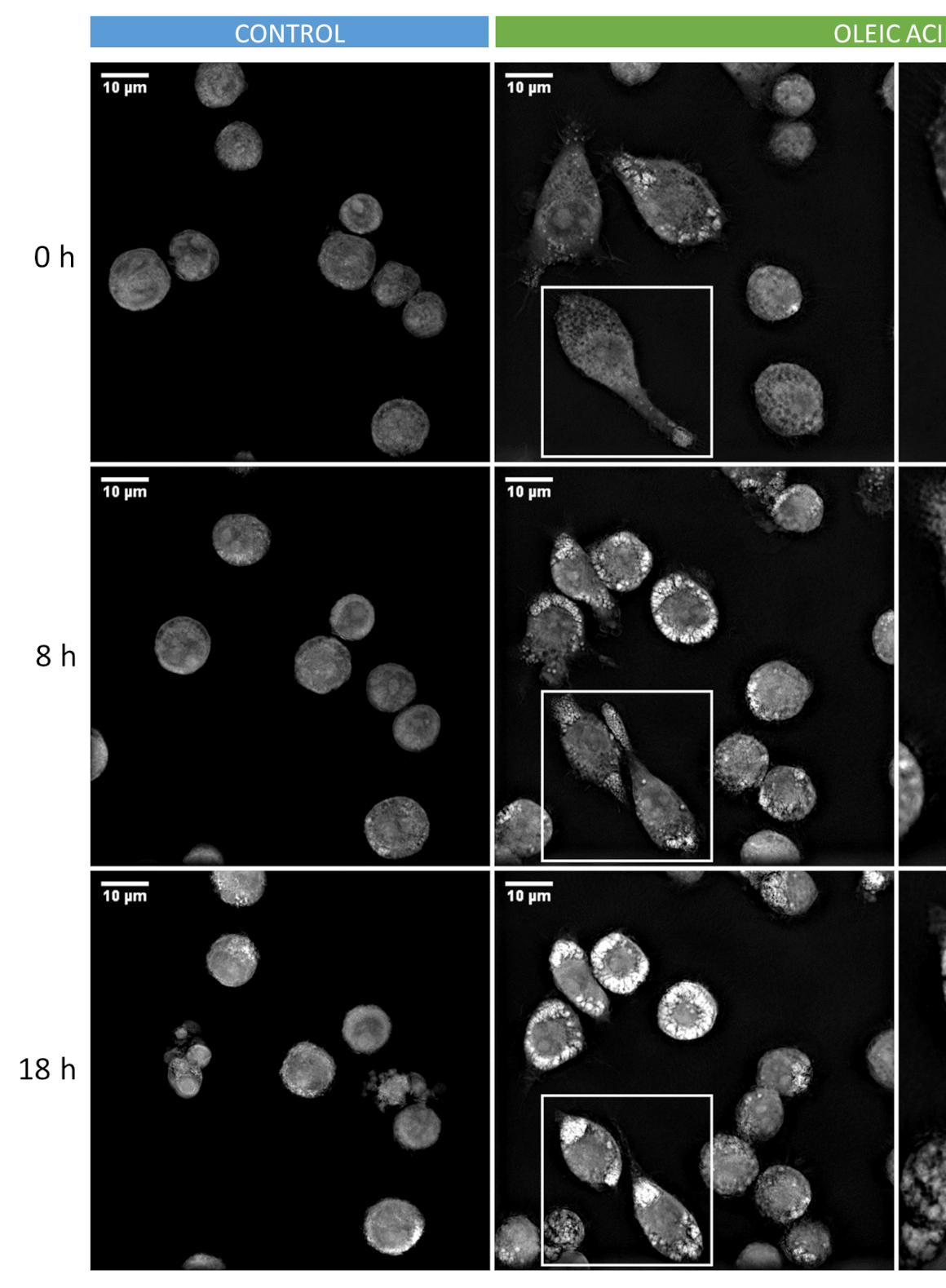 Visualization of Lipid Droplets in the Alveolar Macrophage Cell Line MH-S with Live-cell Imaging by 3D Holotomographic Microscopy (Nanolive)