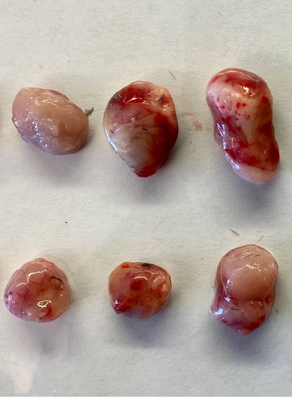 研究免疫细胞依赖性肿瘤发生的肿瘤混合模型