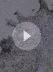 Laser Capture Microdissection (LCM) of Human Skin Sample for Spatial Proteomics Research