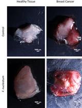 Multiphoton Microscopy of FITC-labelled Fusobacterium nucleatum in a Mouse in vivo Model of Breast Cancer