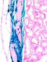 Determining Bone-forming Ability and Frequency of Skeletal Stem Cells by Kidney Capsule Transplantation and Limiting Dilution Assay