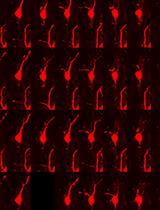 Analysis of Mouse Brain Sections by Live-cell Time-lapse Confocal Microscopy
