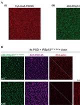 Reconstitution of Membrane-tethered Postsynaptic Density Condensates Using Supported Lipid Bilayer