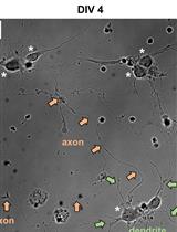 Fluorescence Assays for Real-Time Tracking of Cell Surface Protein Internalization and Endosomal Sorting in Axons of Primary Mouse Hippocampal Neurons