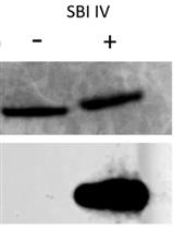 Novel Antibody-independent Method to Measure Complement Deposition on Bacteria